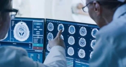 Shkencëtarët zbulojnë 4 zakone të thjeshta që e bëjnë trurin të duket 8 vite më i ri