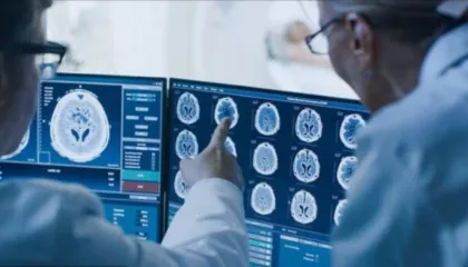 Shkencëtarët zbulojnë 4 zakone të thjeshta që e bëjnë trurin të duket 8 vite më i ri