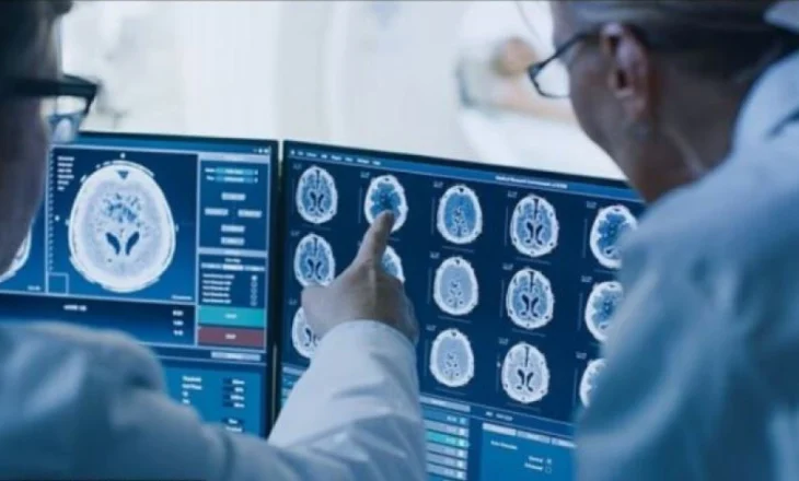 Shkencëtarët zbulojnë 4 zakone të thjeshta që e bëjnë trurin të duket 8 vite më i ri