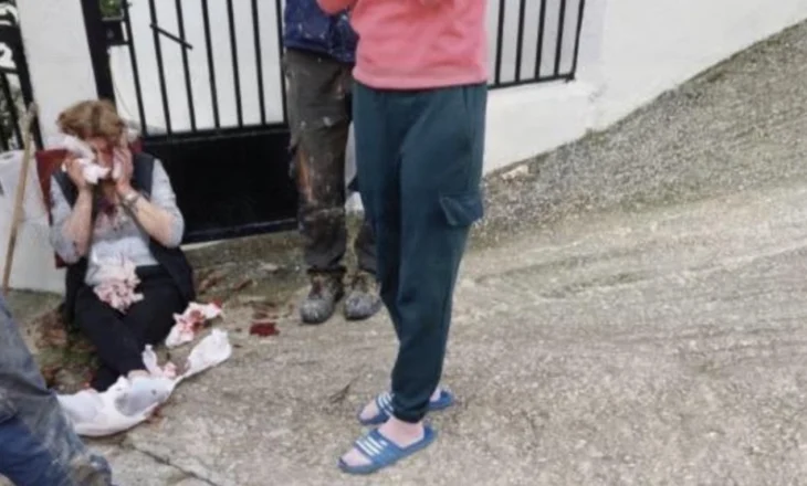 VIDEO/ ‘Bëra atë që doja’, shqiptari masakron me thikë ish-gruan, 50-vjeçarja humb një pjesë të…