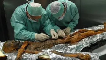 Zbulohet se mumia Ötzi ishte e infektuar me papilloma virus