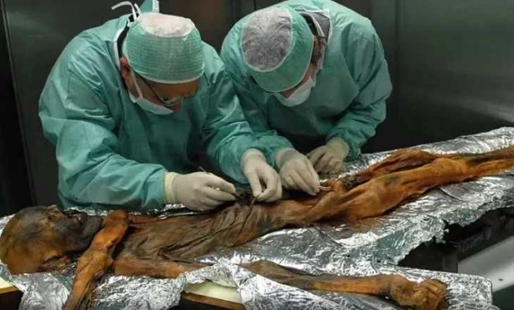 Zbulohet se mumia Ötzi ishte e infektuar me papilloma virus