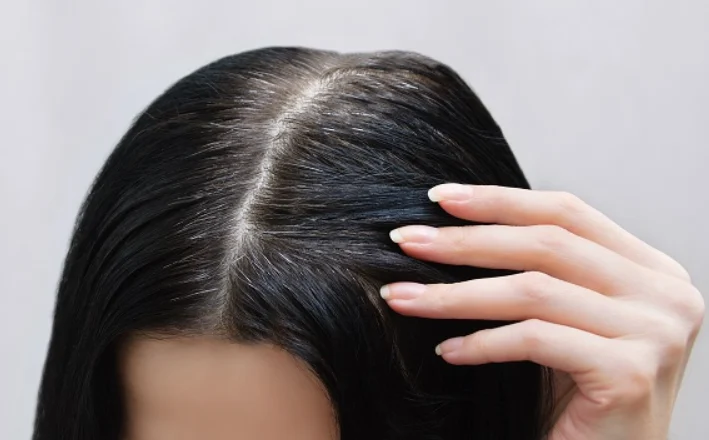 Zbuloni pse dalin thinjat në moshë të re