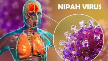 Alarm nga OBSH për virusin Nipah, çfarë është dhe sa të rrezikuar jemi