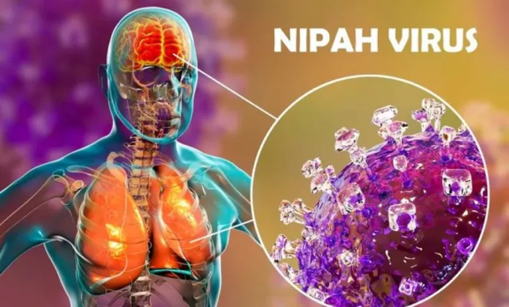 Alarm nga OBSH për virusin Nipah, çfarë është dhe sa të rrezikuar jemi