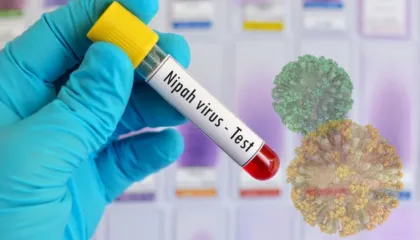 Çfarë është virusi Nipah dhe pse po alarmon botën?
