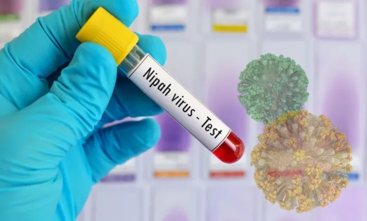 Çfarë është virusi Nipah dhe pse po alarmon botën?