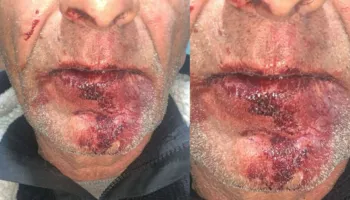 Çifti u dhunua brenda makinës/ Gruaja rrëfen ngjarjen: Jemi ngujuar në shtëpi nga frika të gjithë