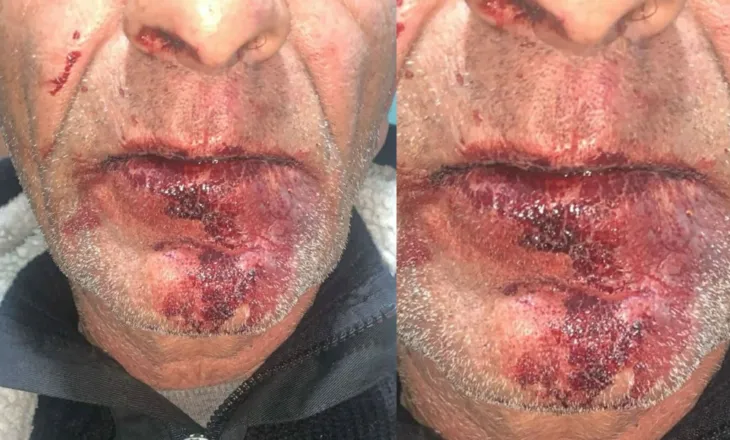 Çifti u dhunua brenda makinës/ Gruaja rrëfen ngjarjen: Jemi ngujuar në shtëpi nga frika të gjithë