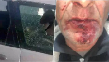 Dhuna barbare ndaj çiftit në Durrës, ngujohet familja: Kemi frikë të dalim se autorët lëvizin të lirë