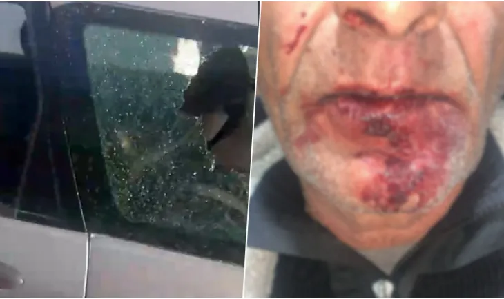 Dhuna barbare ndaj çiftit në Durrës, ngujohet familja: Kemi frikë të dalim se autorët lëvizin të lirë