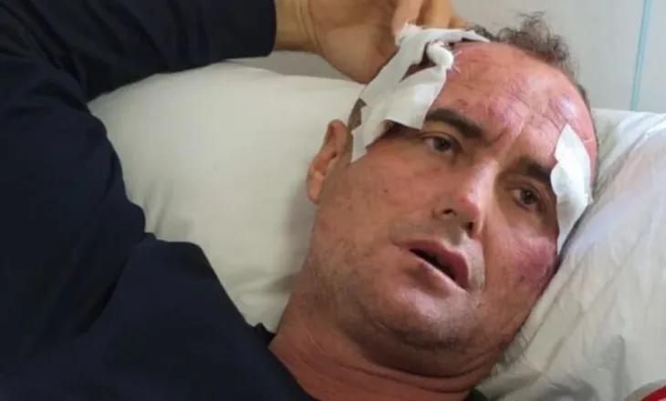 Dhunimi i babë e bir nga polici në Fier, motra e të akuzuarit : E pavërtetë, kam depozituar kallëzim për përndjekje