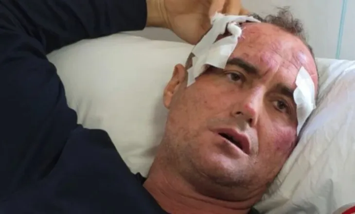 Dhunimi i babë e bir nga polici në Fier, reagon motra e të akuzuarit: E pavërtetë, kam bërë kallëzim për përndjekje