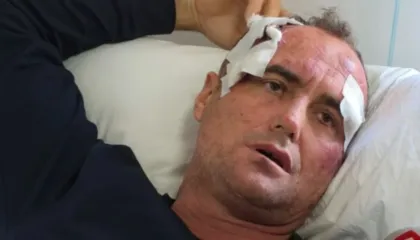 “Dua drejtësi!”, reagon sërish 46-vjeçari nga Fieri: Më dhunuan në shtëpinë time njerëz me uniformën e policisë