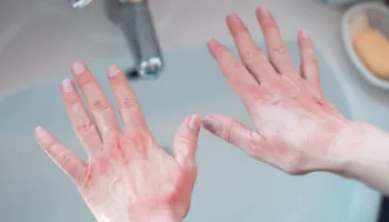 Duart e thata: Një truk menjëherë pas larjes parandalon tharjen