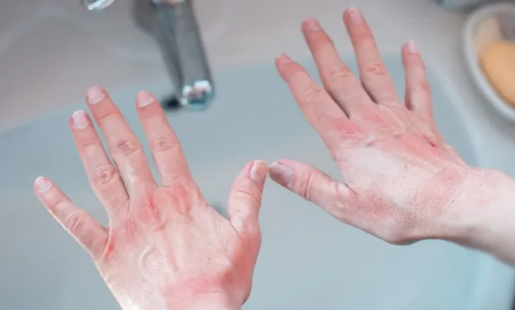 Duart e thata: Një truk menjëherë pas larjes parandalon tharjen