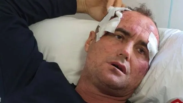 E kam denoncuar për përndjekje, reagon motra e Fredi Lamajt: Altin Mecaj po shpif, vëllai im nuk ka dhunuar askënd