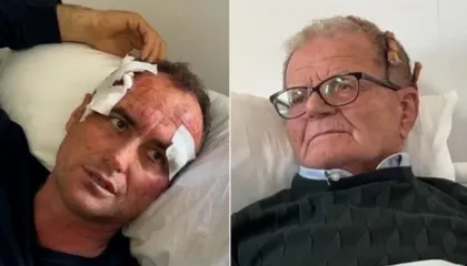 FIER/ Për një kompliment në Facebook-un e së motrës, polici dhunon brutalisht babë e bir (EMRAT)