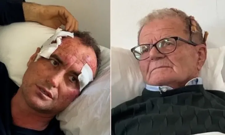 FIER/ Për një kompliment në Facebook-un e së motrës, polici dhunon brutalisht babë e bir (EMRAT)