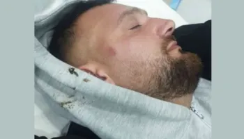 FOTO/ Protestuesi i opozitës denonocon Policinë: Më dhunuan dhe më thanë ik në spital se s’je mirë