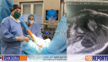 FOTOLAJM – Në Spitalin Rajonal të Shkodrës, realizohet me sukses një tjetër ndërhyrje kirurgjikale…