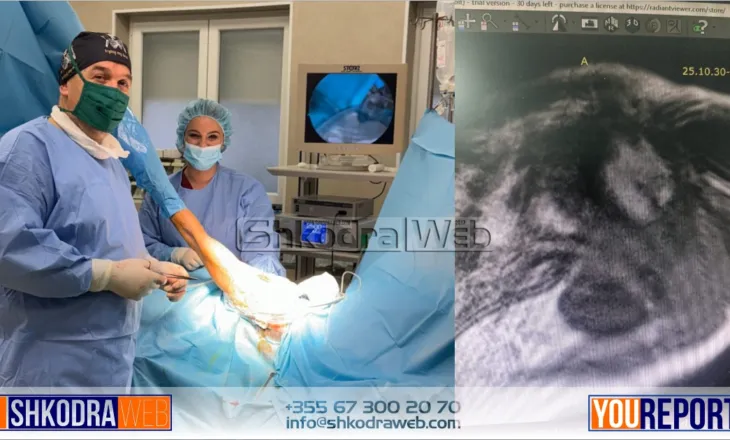 FOTOLAJM – Në Spitalin Rajonal të Shkodrës, realizohet me sukses një tjetër ndërhyrje kirurgjikale…