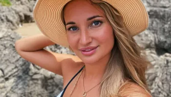 Humb jetën influencuesja italiane pas operacioneve estetike