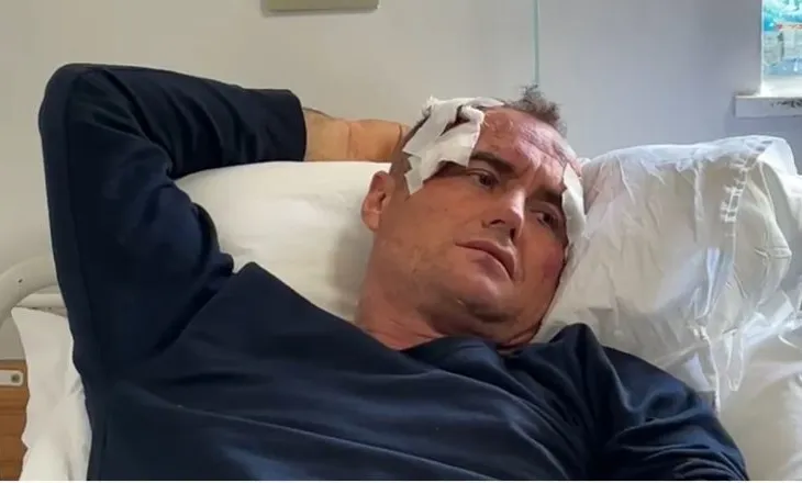 I riu dhunohet nga polici në Fier: I komentova motrës së tij në Facebook je bërë shumë e bukur