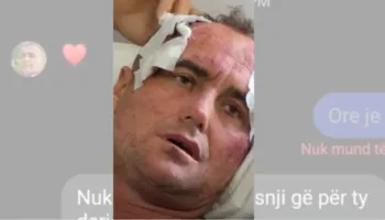 “Je më e bukura e fshatit”, reagon motra e 46-vjeçarit të dhunuar pas publikimit të mesazheve: Mjaft me këtë telenovelë, s’kërkojmë hakmarrje por..