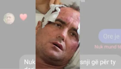 “Je më e bukura e fshatit”, reagon motra e 46-vjeçarit të dhunuar pas publikimit të mesazheve: Mjaft me këtë telenovelë, s’kërkojmë hakmarrje por..