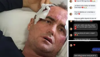 “Jo vetëm një koment…Je femra më e bukur e fshatit”/ Dhunimi i 46-vjeçarit në Fier, motra e të akuzuarit nxjerr mesazhet: E kam denoncuar