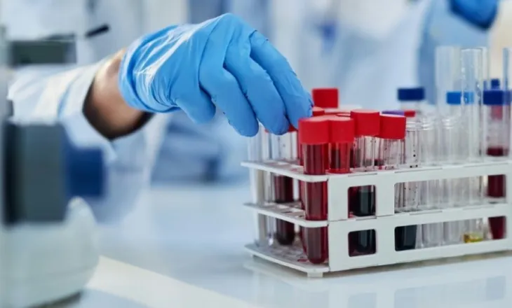 Keni kaluar moshën 40? Këto 4 ekzaminime janë të domosdoshme, sipas mjekut