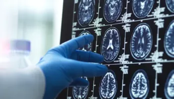 Këto janë moshat në jetën tonë kur truri ynë ndryshon