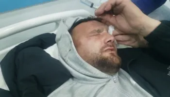 ‘Mbi 4 orë në komisariat dhe e dhunuan’/ Pasi gjendja e protestuesit u përkeqësua i thanë ik në spital se s’je mirë