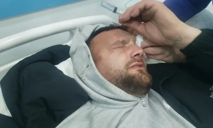 ‘Mbi 4 orë në komisariat dhe e dhunuan’/ Pasi gjendja e protestuesit u përkeqësua i thanë ik në spital se s’je mirë