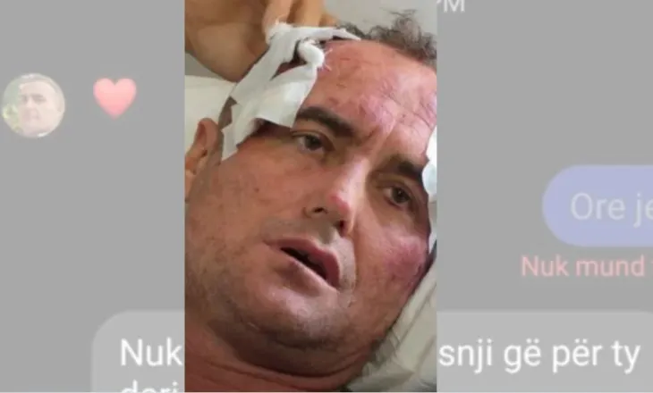 “Mos ki frikë nga unë, të pres në Vjosë”/ Zbulohen mesazhet, ja çfarë i shkruante 46-vjeçari motrës së policit në Fier: Të dëshiroj si i çmendur, pse i the Fredit…