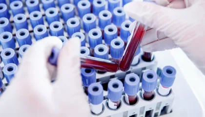 Njihuni me Rh-null, ‘gjaku i artë’ që ka ngjallur interes të madh te shkencëtarët për ta riprodhuar në laborator