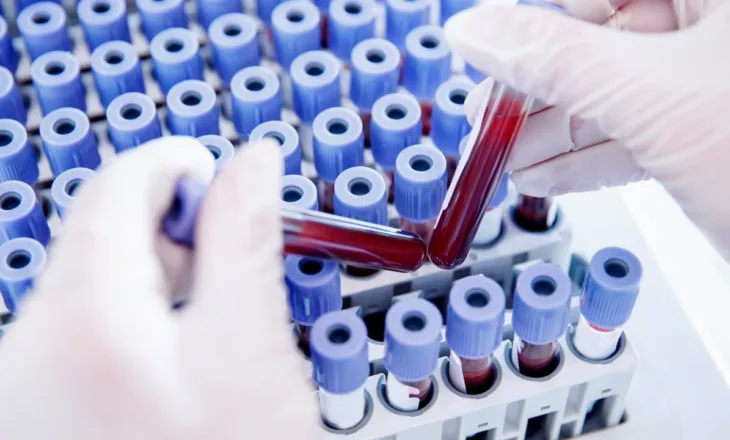 Njihuni me Rh-null, ‘gjaku i artë’ që ka ngjallur interes të madh te shkencëtarët për ta riprodhuar në laborator