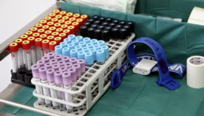 OBSH: Rreziku i përhapjes së virusit Nipah përtej Indisë është i ulët