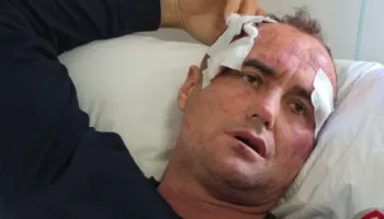 Pas publikimit të mesazheve, reagon motra e 46-vjeçarit të dhunuar, Altin Meçaj: Nuk kërkojmë hakmarrje por…