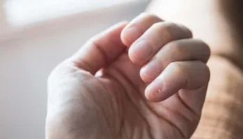 Pesë shenja që ju japin duart kur keni problem me tiroiden