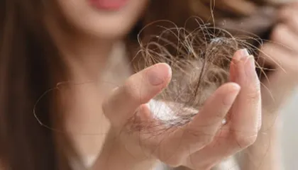 Pesë ushqimet që ju ndihmojnë kundër rënies së flokëve