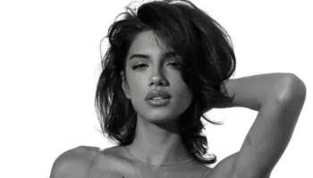 Pëson hemorragji cerebrale – hapet GoFundMe për modelen shqiptare Dajana Kalo