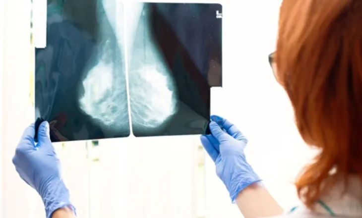 Revolucion në trajtimin e kancerit të gjirit, testi i studiuesve britanikë parashikon se cila terapi është më efektivja për pacientin