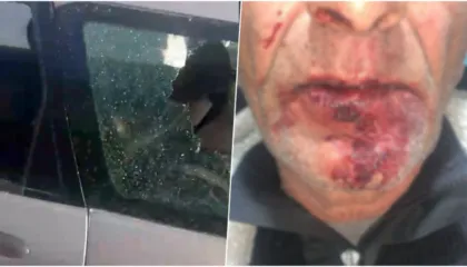 U dhunuan brenda makinës, gruaja tregon si ndodhi ngjarja: Jemi ngujuar në shtëpi nga frika