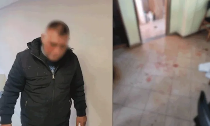 “Urdhrin e dha…”/ U dhunua në lokal, Nikolin Marku akuzon: Vëllai i ish-deputetit të PS më kërcënoi në spital