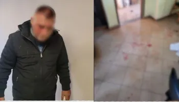 “Urdhrin e dha vëllai i Arben Ndokës”! U dhunua në lokalin në Lezhë, Nikolin Marku: Gëzimi më kërcënoi në spital