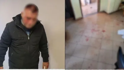 “Urdhrin e dha vëllai i Arben Ndokës”! U dhunua në lokalin në Lezhë, Nikolin Marku: Gëzimi më kërcënoi në spital