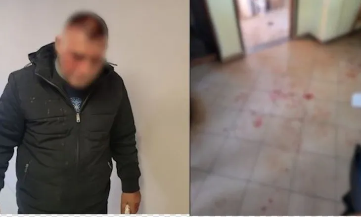 “Urdhrin e dha vëllai i Arben Ndokës”! U dhunua në lokalin në Lezhë, Nikolin Marku: Gëzimi më kërcënoi në spital