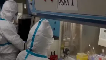 Virusi ‘Nipah’ jo rrezik imediat për Shqipërinë, Bino: Nuk përhapet nga ajri